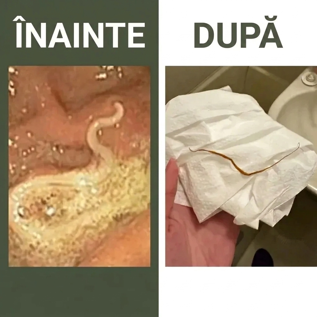 Pachet Detox cu ulei de ricin